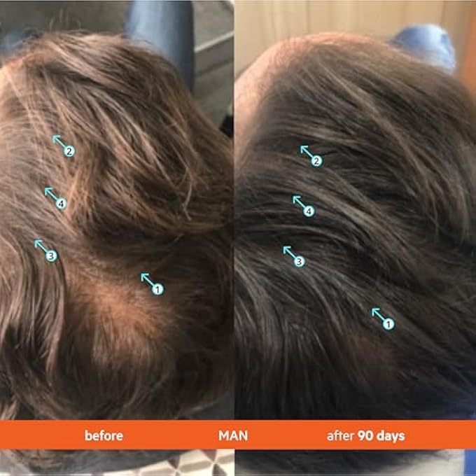 DS LABORATORIES DS LABS REVITA CONDITIONER, 205ML - LIGHTWEIGHT, SCALP FIRST HYDRATION FOR FULLER LOOKING, SOFTER HAIR, THICKENING APPEARANCE, SULFATE & SILICONE FREE, COLOR SAFE, FOR MEN & WOMEN - Image 3