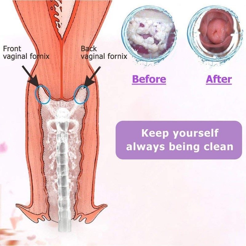 SOLARAE Vaginal Cleansing System 300ml, Reusable Feminine Hygiene Rinse Bottle with Manual Pressure Pump, 4.6 Inch Nozzle, Portable Personal Cleaner - Image 4