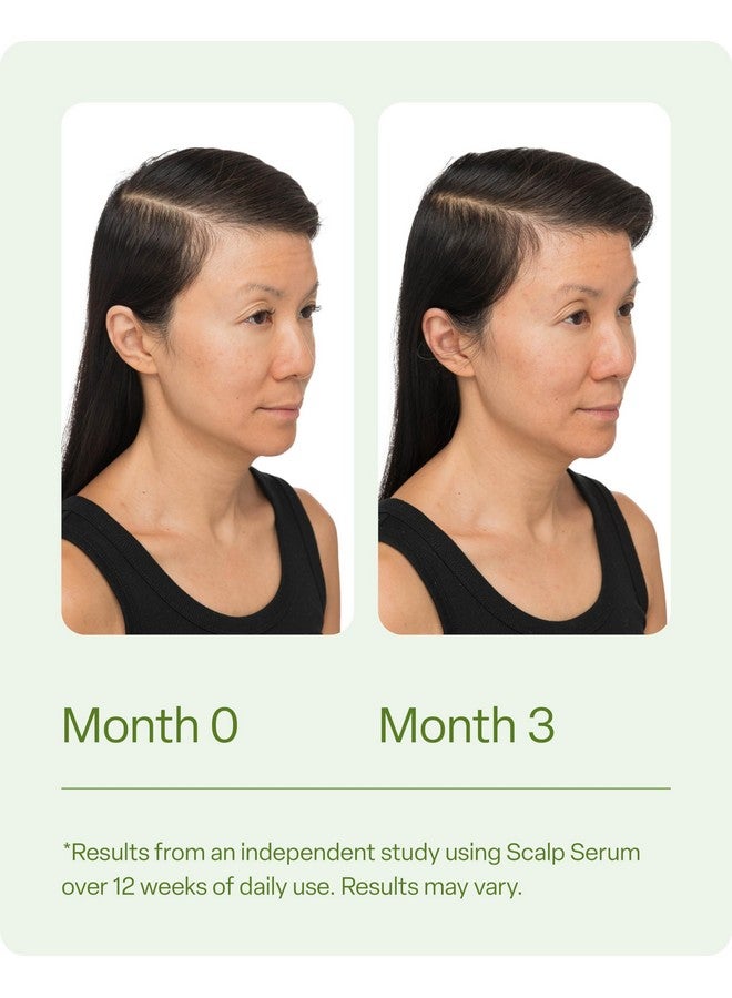 Divi Hair Scalp Serum for Women and Men - Revitalize and Balance Your Scalp - Improves Appearance of Thinning Hair, Nourishes the Scalp and Helps Remove Product and Oil Buildup, 100ml - Image 4