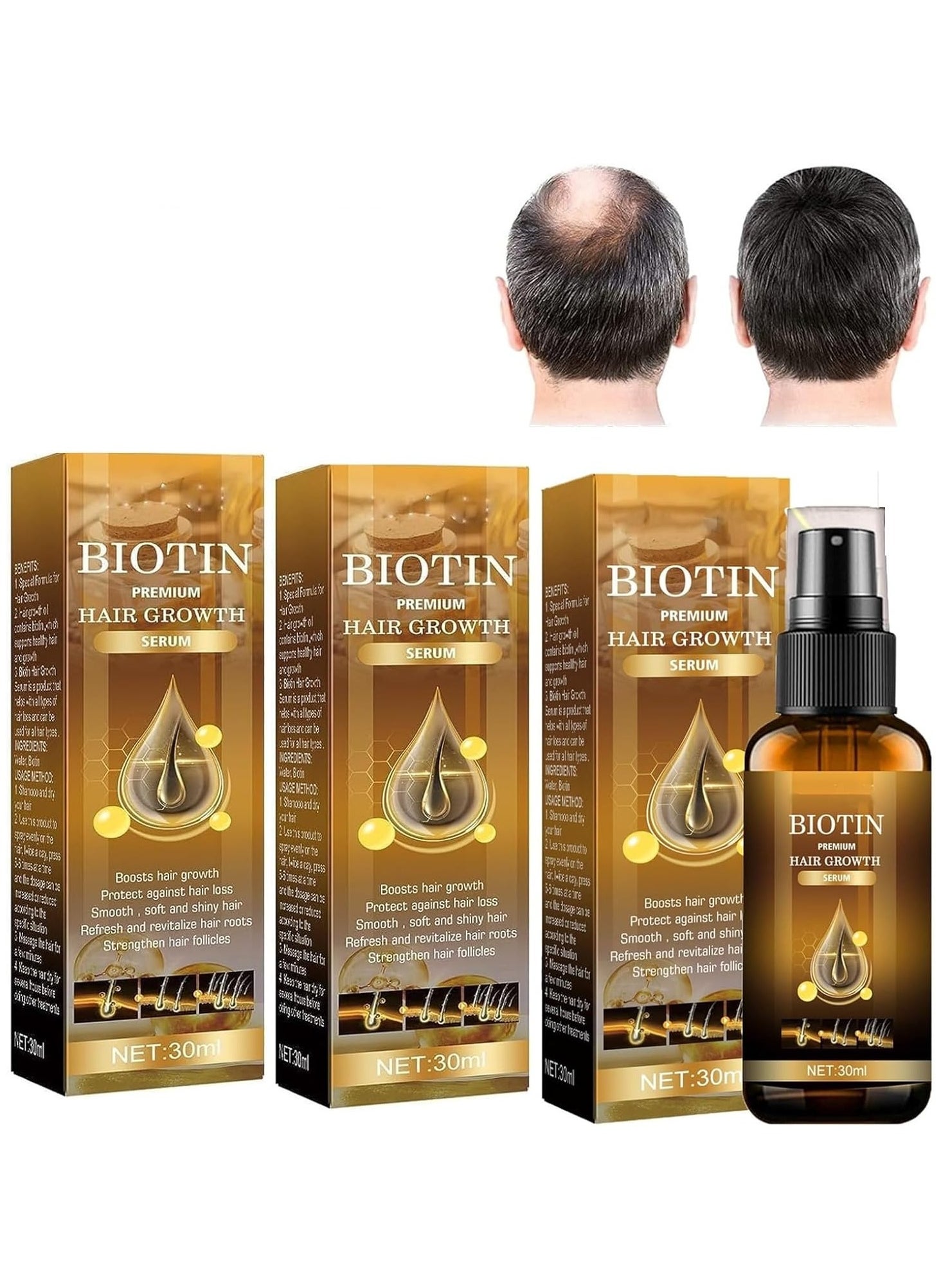 EELHOE Biotin Hair Growth Spray,Hair Regrowth Spray,Biotin Hair Growth Serum,Hair&Beard Serum Spray,Fast Growing Hair Care Essential Oils,For All Hair Types (1 Pc) 