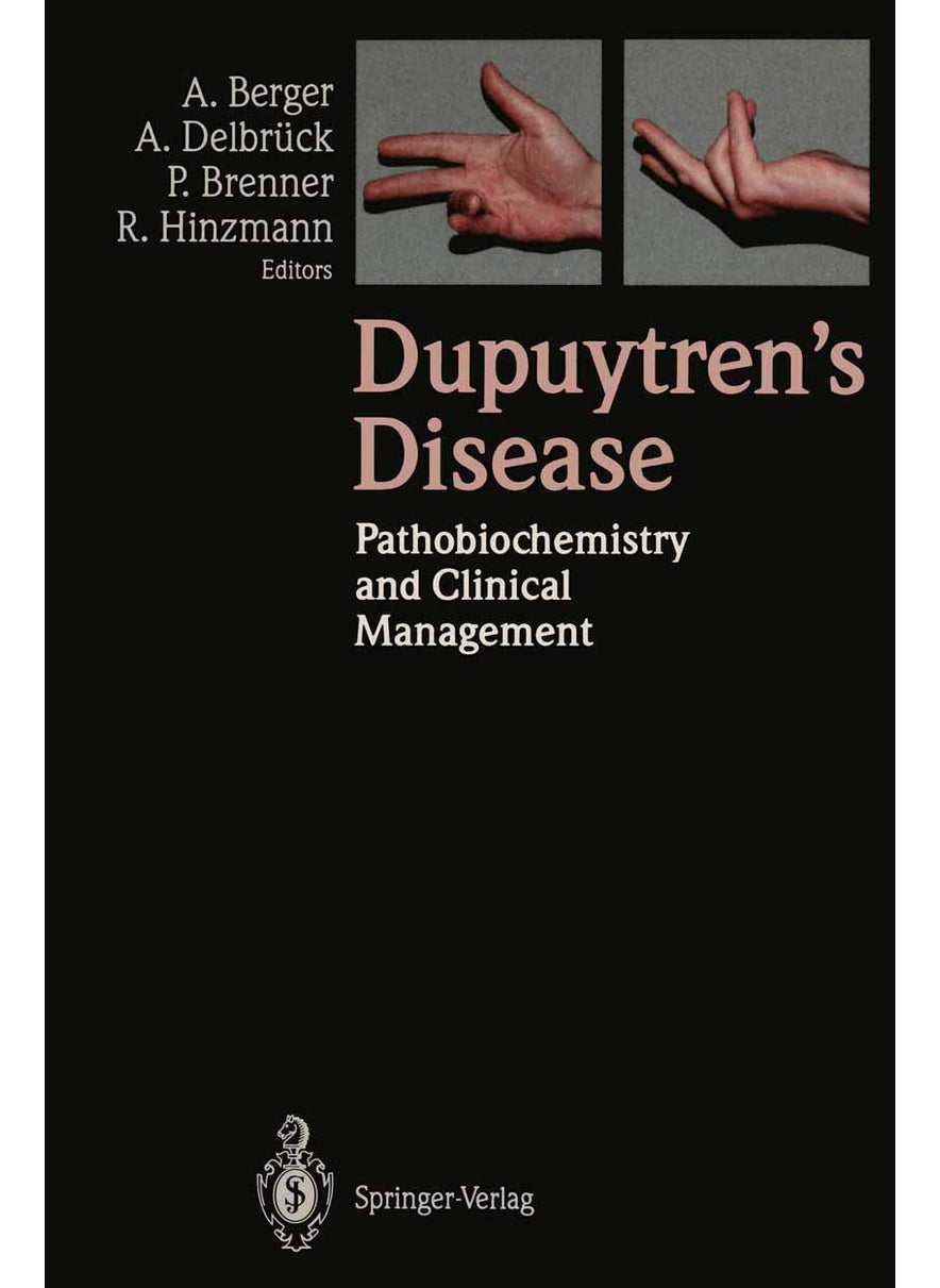 Dupuytren's Disease: Pathobiochemistry and Clinical Management 