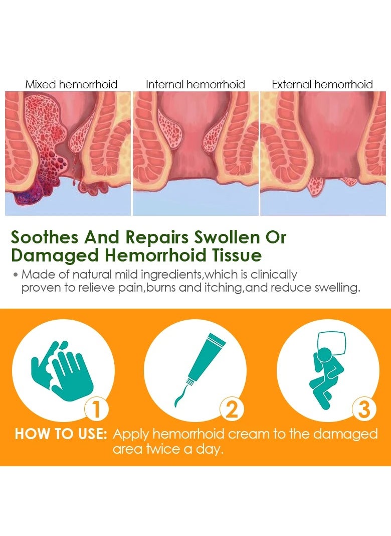 HBESTY - Hemorrhoids Removal Ointment Medicine Pain Relief Cream Internal Hemorrhoids Piles External Anal Fissure Health Care - Image 1