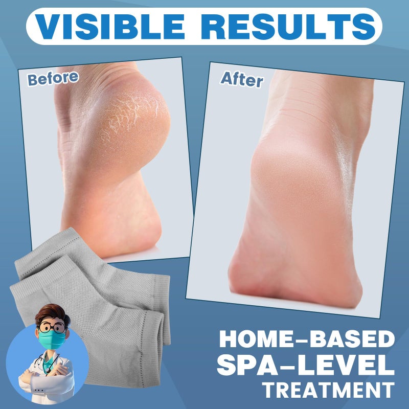 TEAWOO Moisturizing Heel Socks - 6 Pairs for Dry Cracked Feet, Toeless Gel Socks for Hydration and Repair - Image 2