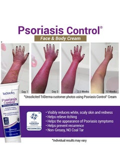 TriDerma TriDerma Psoriasis Control Face and Body Cream, 4.2 Ounces  - Image 2