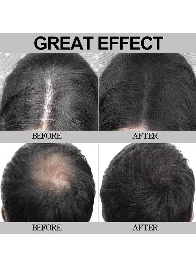 VERONNI Hairline Powder Root Touch Up Hair Color, Hairline Shadow Powder, Hairline Powder Instantly Conceals, Instant Volume And Scalp Coverage For Thinning Hair, Fast And Full Care, 100% Water Sweat Resistant (Black) - Image 3