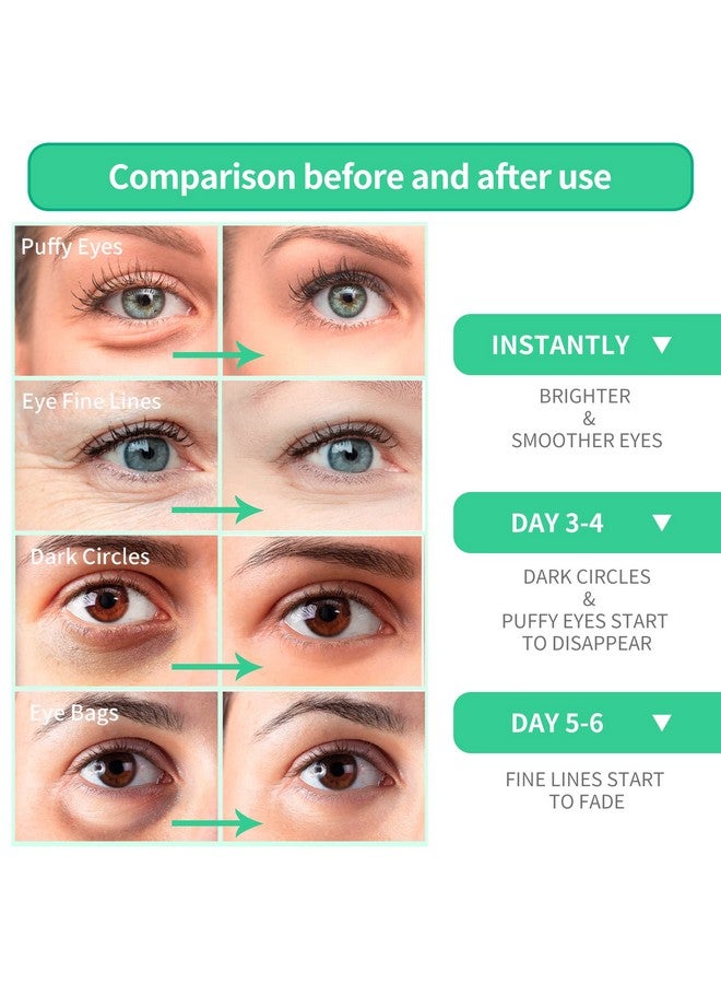 Breylee Aloe Vera Eye Mask 60 Pcs Puffy Eyes And Dark Circles Treatments Look Younger And Reduce Wrinkles And Fine Lines Undereye Improve And Firm Eye Skin Pure Natural Material Extraction - Image 3