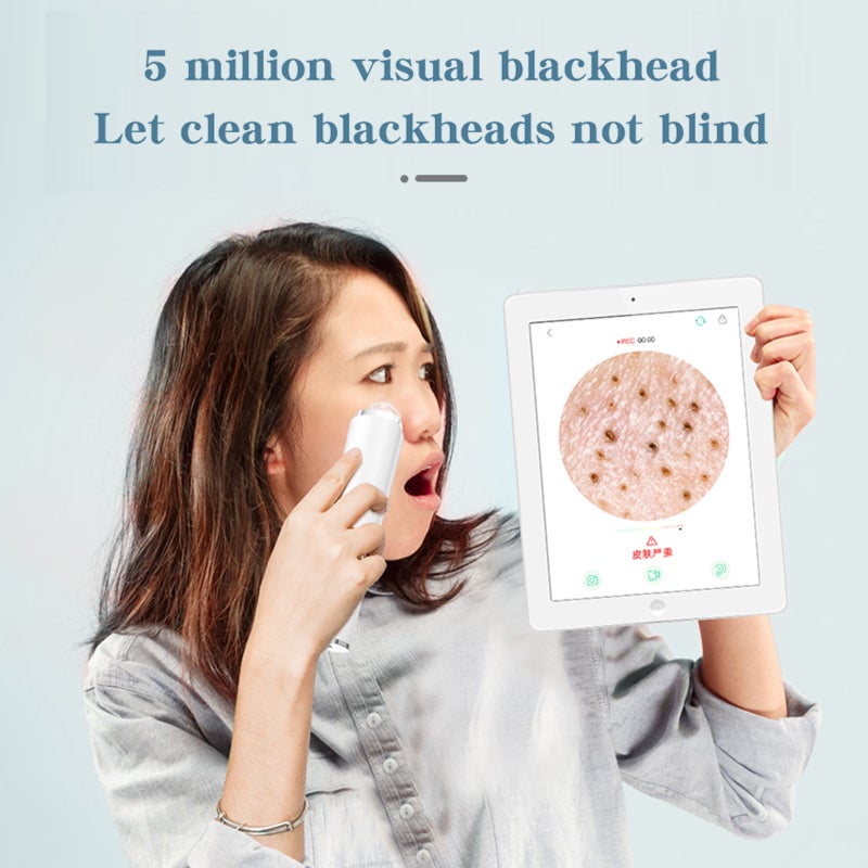 5.0MP Intelligent Visual Blackhead Remover Blackhead Instrument Vacuum 3 Suction Level 6 Heads USB Rechargeable Electric Facial Pore Cleanser Acne Comedone Pimple Extractor Sucker Tool Sync Photo - Image 5