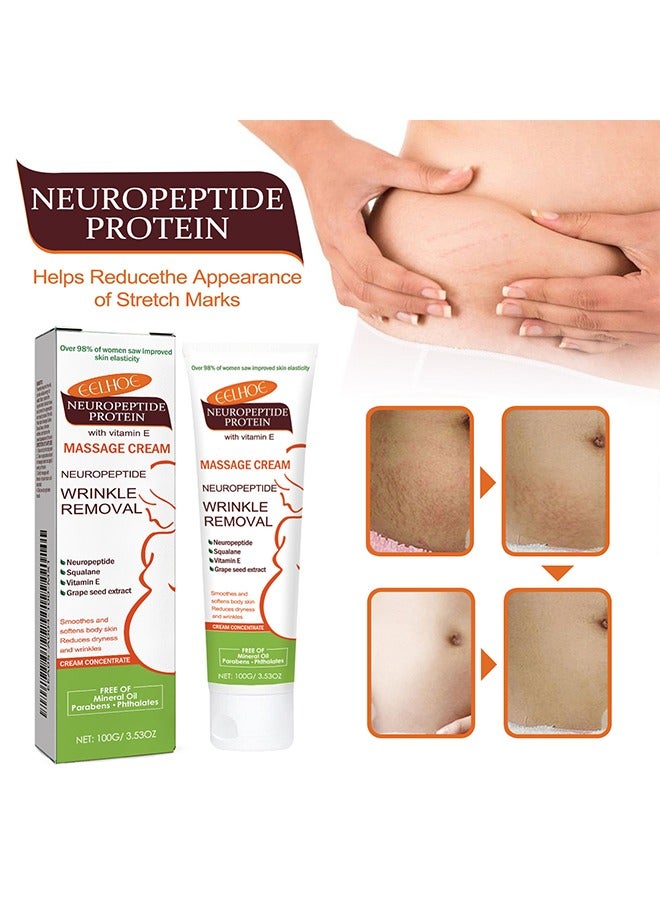 EELHOE Neuropeptide Protein With Vitamin E Massage Cream-Fade Scar Pregnancy Marks Care Smooth Skin Massage Cream 100g - Image 2