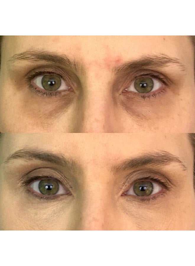 dermaflage لوحة تصحيح الألوان، خافي عيوب تصحيح الألوان للهالات السوداء، الاحمرار، الكدمات، البقع الداكنة، من ديرمافلاج 6.9غ/.24أونصة - Image 4