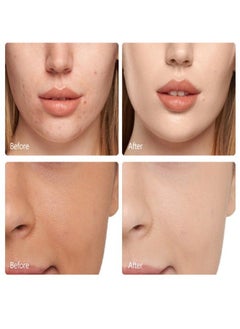 GUANJING Kojic Acid Essence Toner for Face and Body, Effectively Replenish Nutrients Improve Dryness Soften Cuticles Minimize Poreslighten Acne Scars Soothe and Repair Skin  - Image 3