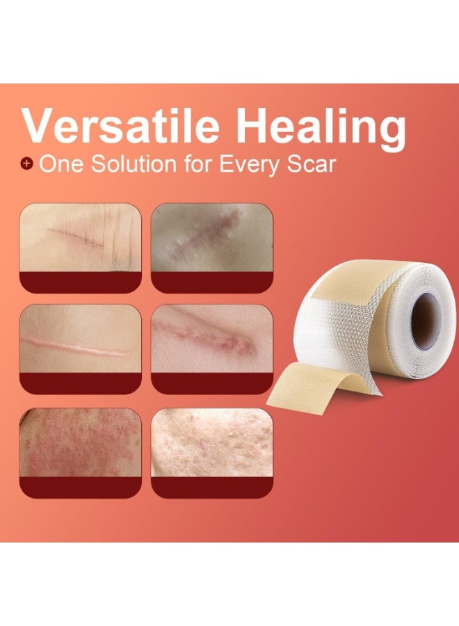 ningnatural Silicone Scar Sheets 1.5ms Medical Silicone Scar Tape Roll Easy Tear Soft Silicone Tape for Scars Removal Reusable Painless Silicone Sheets for Surgery Scars Section Burn Keloid - Image 5