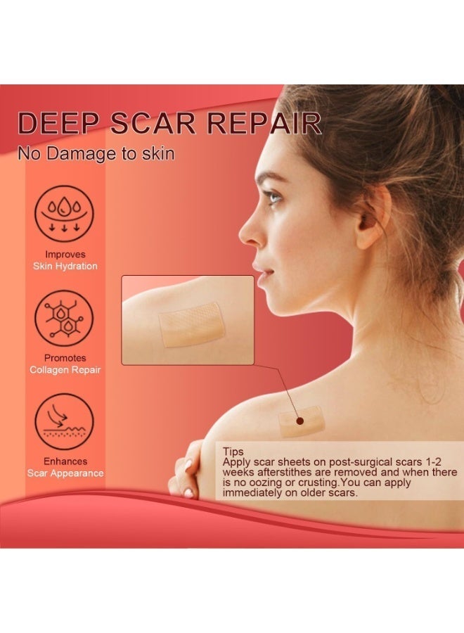 ningnatural Silicone Scar Sheets 1.5ms Medical Silicone Scar Tape Roll Easy Tear Soft Silicone Tape for Scars Removal Reusable Painless Silicone Sheets for Surgery Scars Section Burn Keloid - Image 2