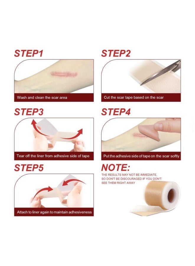 ningnatural Silicone Scar Sheets 1.5ms Medical Silicone Scar Tape Roll Easy Tear Soft Silicone Tape for Scars Removal Reusable Painless Silicone Sheets for Surgery Scars Section Burn Keloid - Image 3