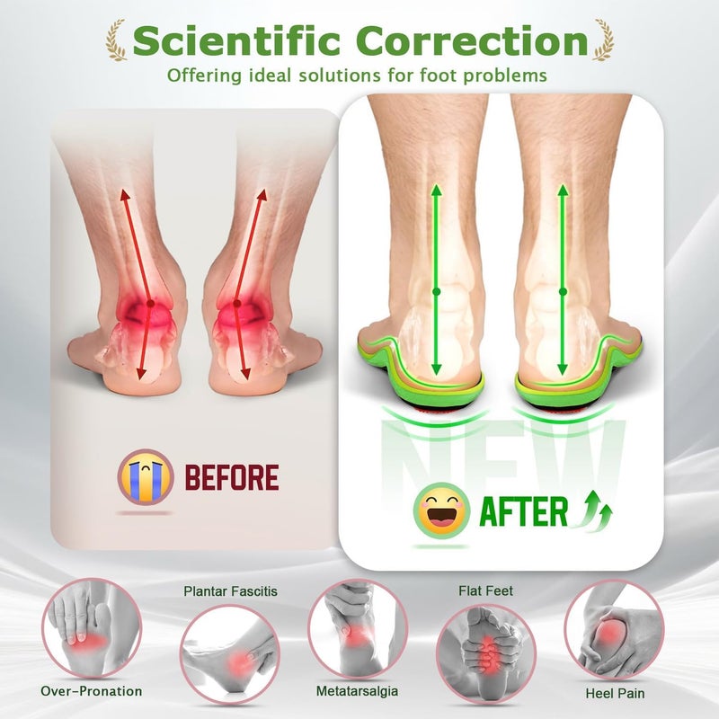 Arch Support Insoles for Men and Women - Image 3