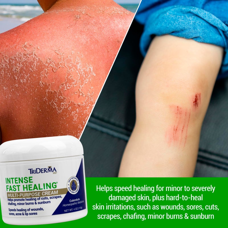 TriDerma Intense Fast Healing Cream, Decreases Healing Time for Minor Irritations, Rashes, Scrapes, Cuts 4 Ounces - Image 2