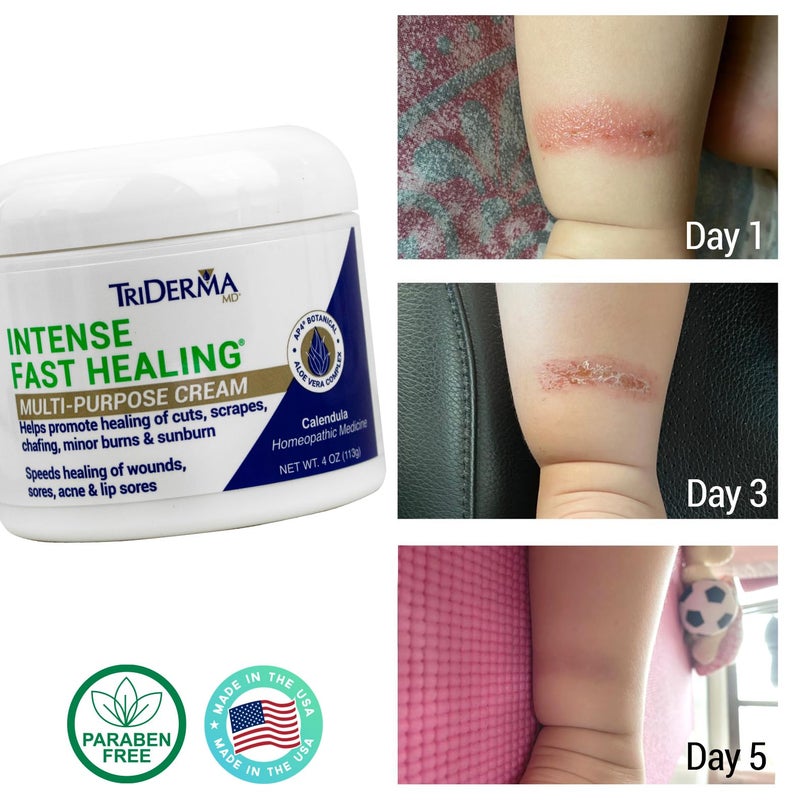 TriDerma Intense Fast Healing Cream, Decreases Healing Time for Minor Irritations, Rashes, Scrapes, Cuts 4 Ounces - Image 3