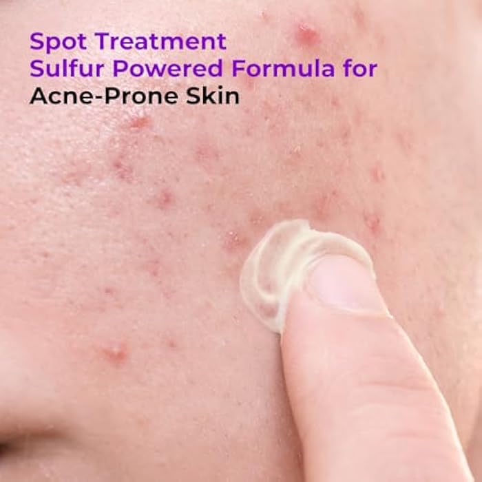 GLAM UP Spotless 10% Sulfur Treatment Spot Serum for Fast Healing Pimples, Blemishes and Acne Breakouts, Overnight Acne Soothing15mL, 0.5 fl. oz. [Made in the US] - Image 4