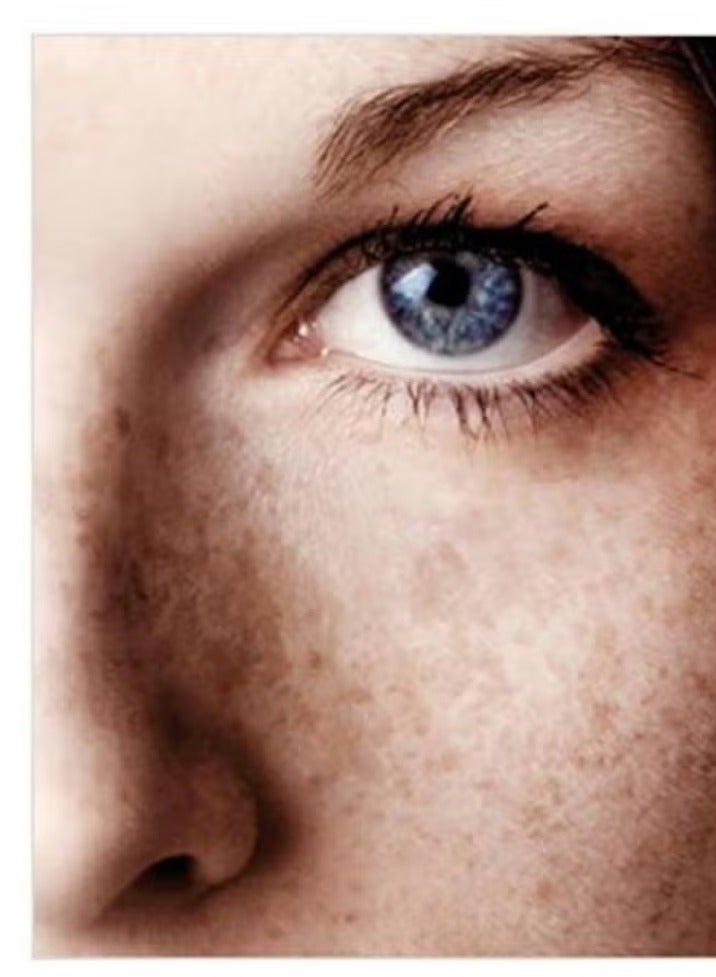 اكم لابرتوري ديرماتولوجيك ايه سي ام كريم ديبي وايت ادفانسد المضاد للتجاعيد والبقع البنية - 40 مل - Image 3