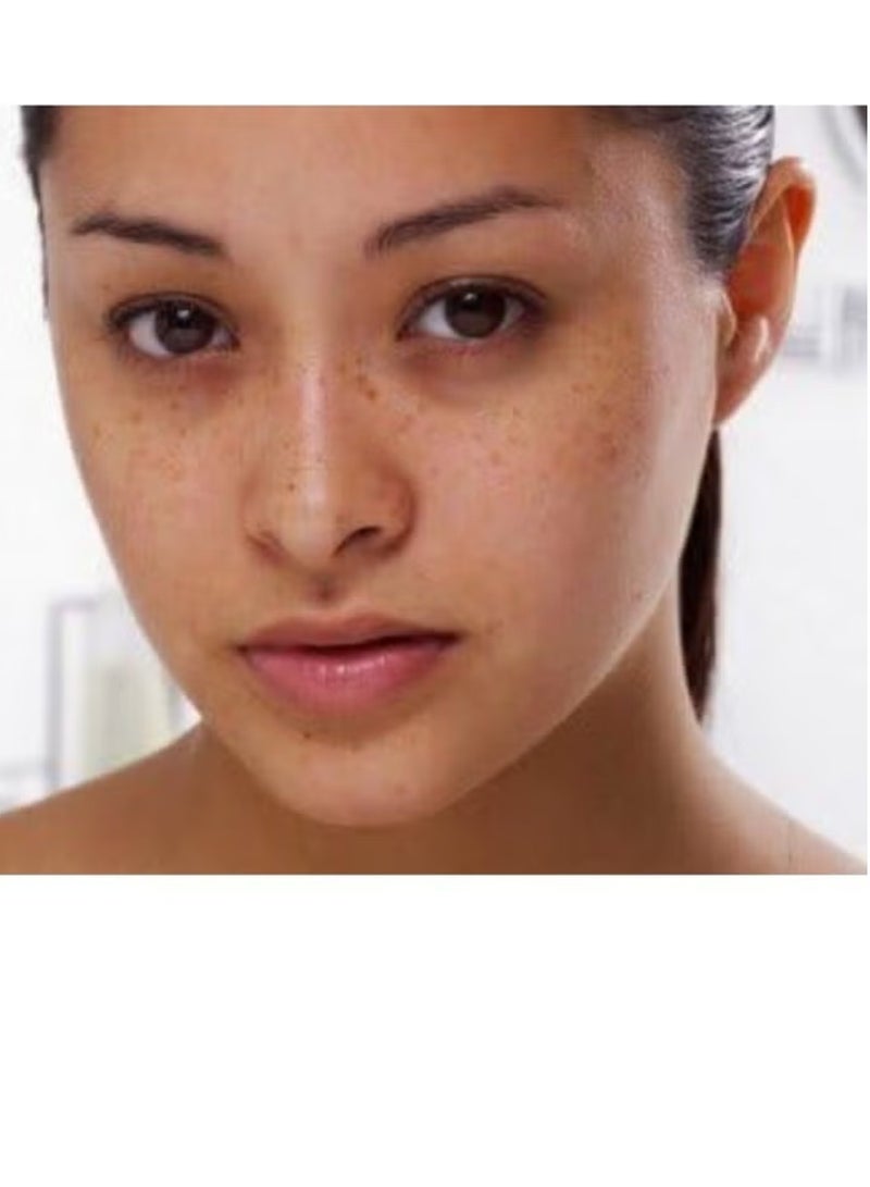 اكم لابرتوري ديرماتولوجيك ايه سي ام كريم ديبي وايت ادفانسد المضاد للتجاعيد والبقع البنية - 40 مل - Image 4