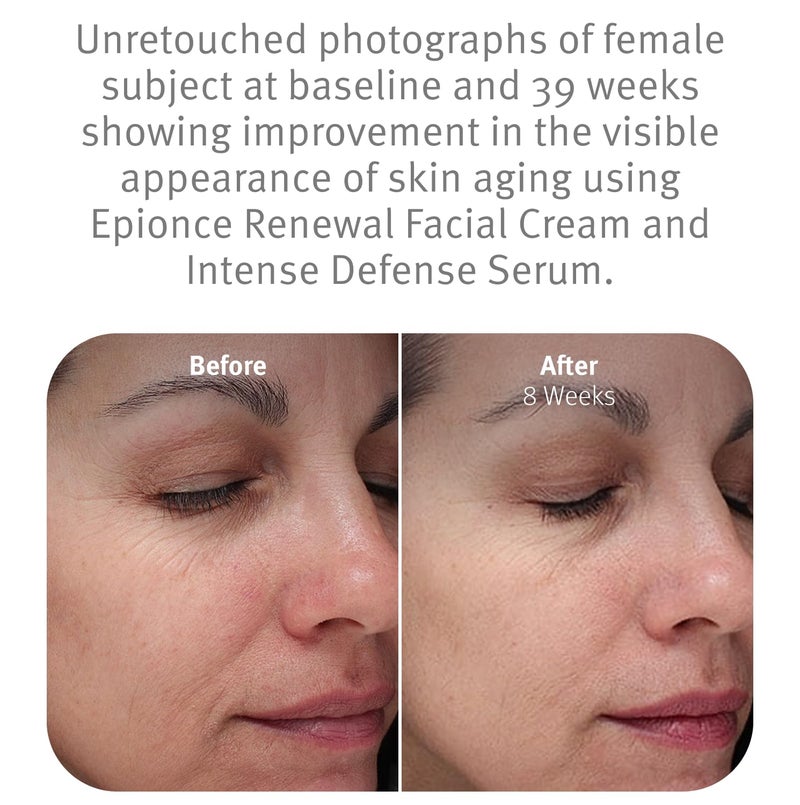 Epionce Renewal Facial Cream â€“ Hydrating Anti-Aging Moisturizer | For Dry, Sensitive to Normal Skin | Fine Lines & Wrinkles | Dermatologist Skincare - Image 4