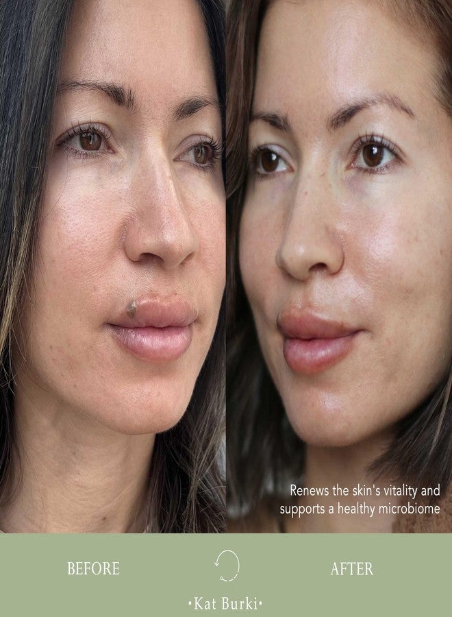 Kat Burki pH+ Enzyme Essence Face Pre Serum Radiance Boosting Anti-Blemish Care that Promotes Skin Renewal, 3.4 fl. oz. - Image 4