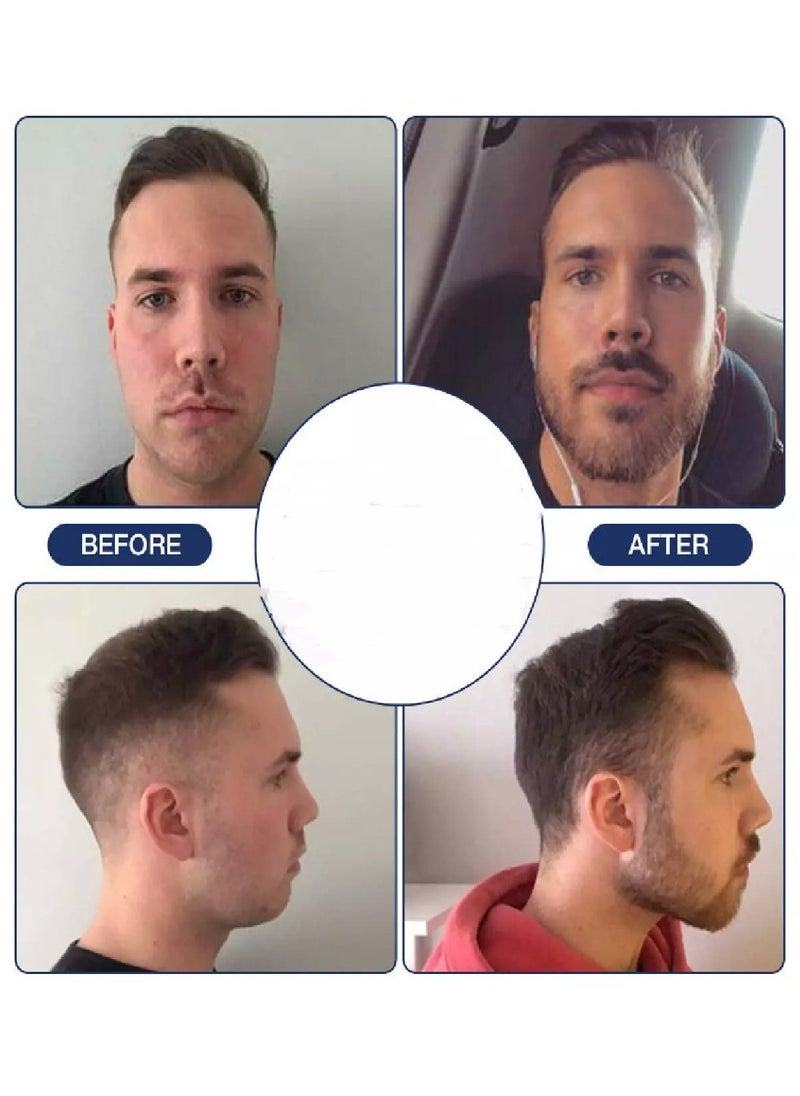 Generic - Jaw Muscle Trainer For Men and Women Facial Muscle Chewizer Bite Muscle Exercise Tightening Jaw Trainer Grey, Jaw Shaper Slims And Shapes Your Face And Neck - Image 1