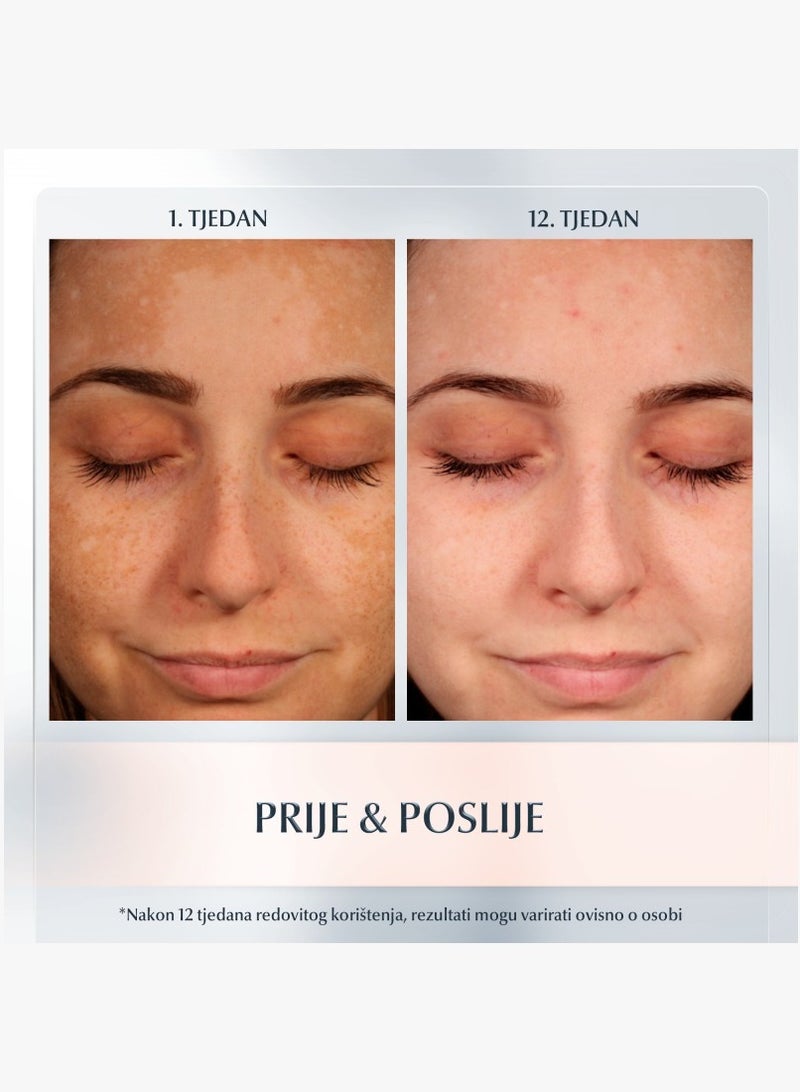 يوسيرين كريم انتي بجمنت مضاد للتصبغ مع30SPF واقي شمس 50 مل - Image 2