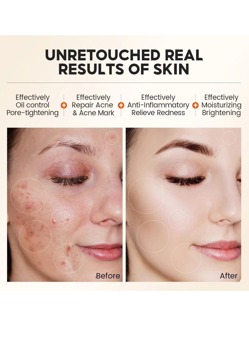 Vibrant Glamour 60g 1% Salicylic Acid Exfoliating Mask Face Exfoliating Mask Reduce Redness and Acne Scars Hydrates and Nourish Skin AHA BHA Clarifying Treatment for Blemish Prone Skin  - Image 2