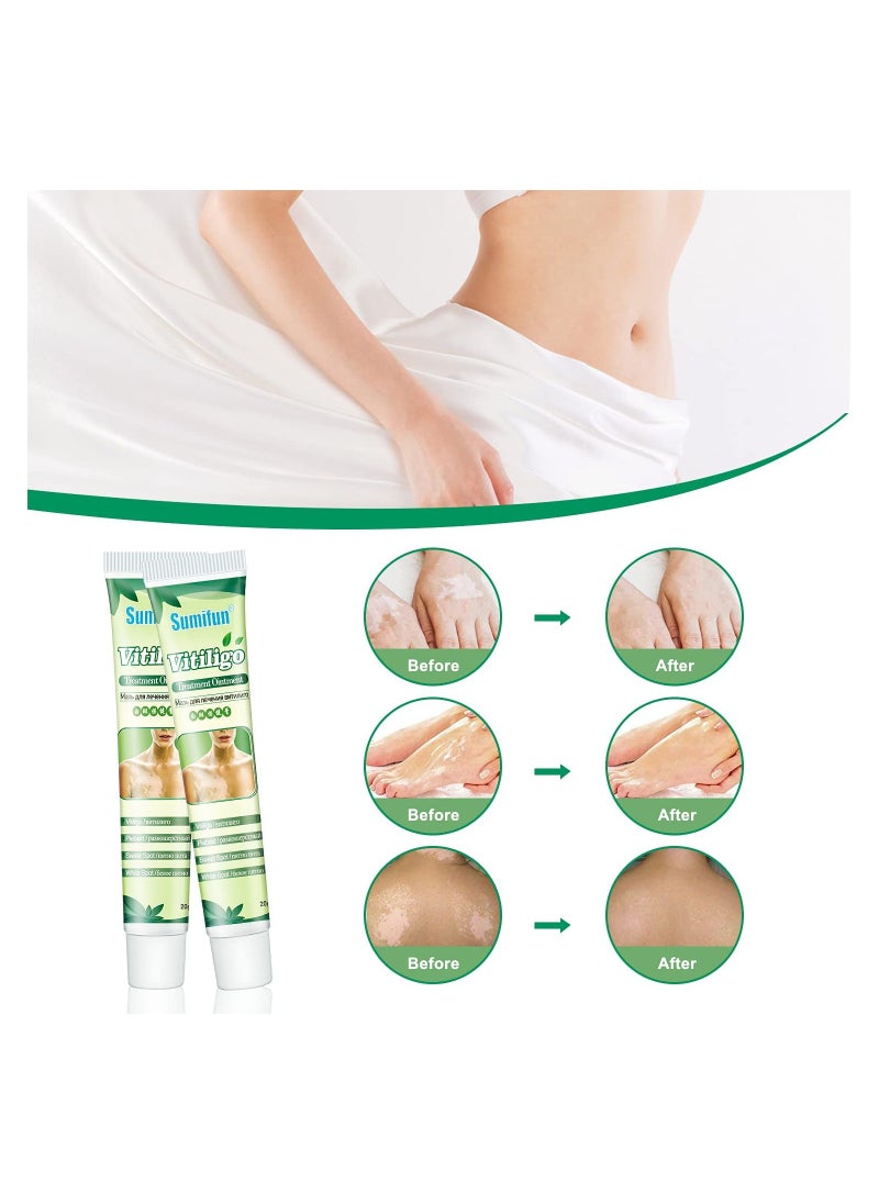 Sumifun - 2 Counts Vitiligo Cream for Skin Vitiligo Treatment Leukoplakia White Spots on Skin & Improve Skin Pigmentation - Image 1