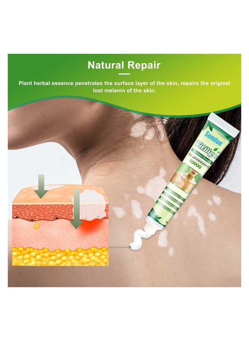 Sumifun - 2 Counts Vitiligo Cream for Skin Vitiligo Treatment Leukoplakia White Spots on Skin & Improve Skin Pigmentation - Image 1