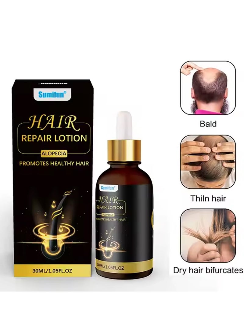 Sumifun 1PC 30ML Natural Organic Alopecia Hair Repair Lotion - Image 1