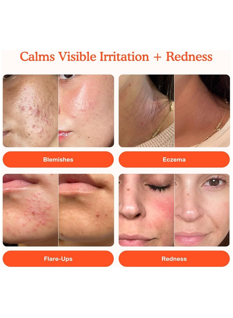 TOWER 28 SOS Daily Rescue Facial Spray for Sensitive Skin, Hypochlorous Acid Spray Helps Reduce Redness and Breakouts, Full Size Toner for Face 120ml - Image 2