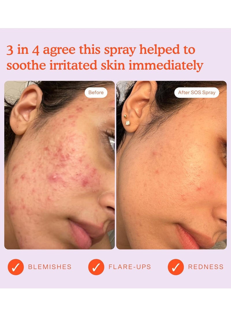 TOWER 28 SOS Daily Rescue Facial Spray for Sensitive Skin, Hypochlorous Acid Spray Helps Reduce Redness and Breakouts, Full Size Toner for Face 120ml - Image 4