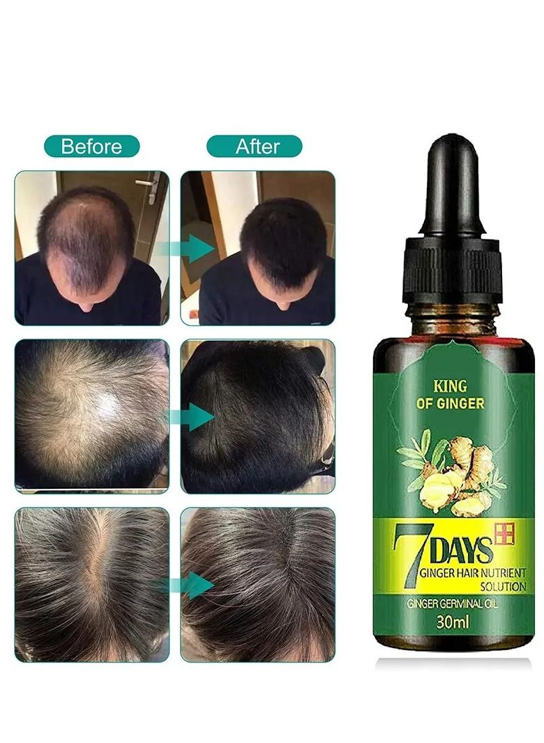 Generic 7DAYS Ginger Hair Oil Scalp Massage Strenthening Repair Fast loss treatment, Hair Growth Oil Serum 30ml  - Image 5