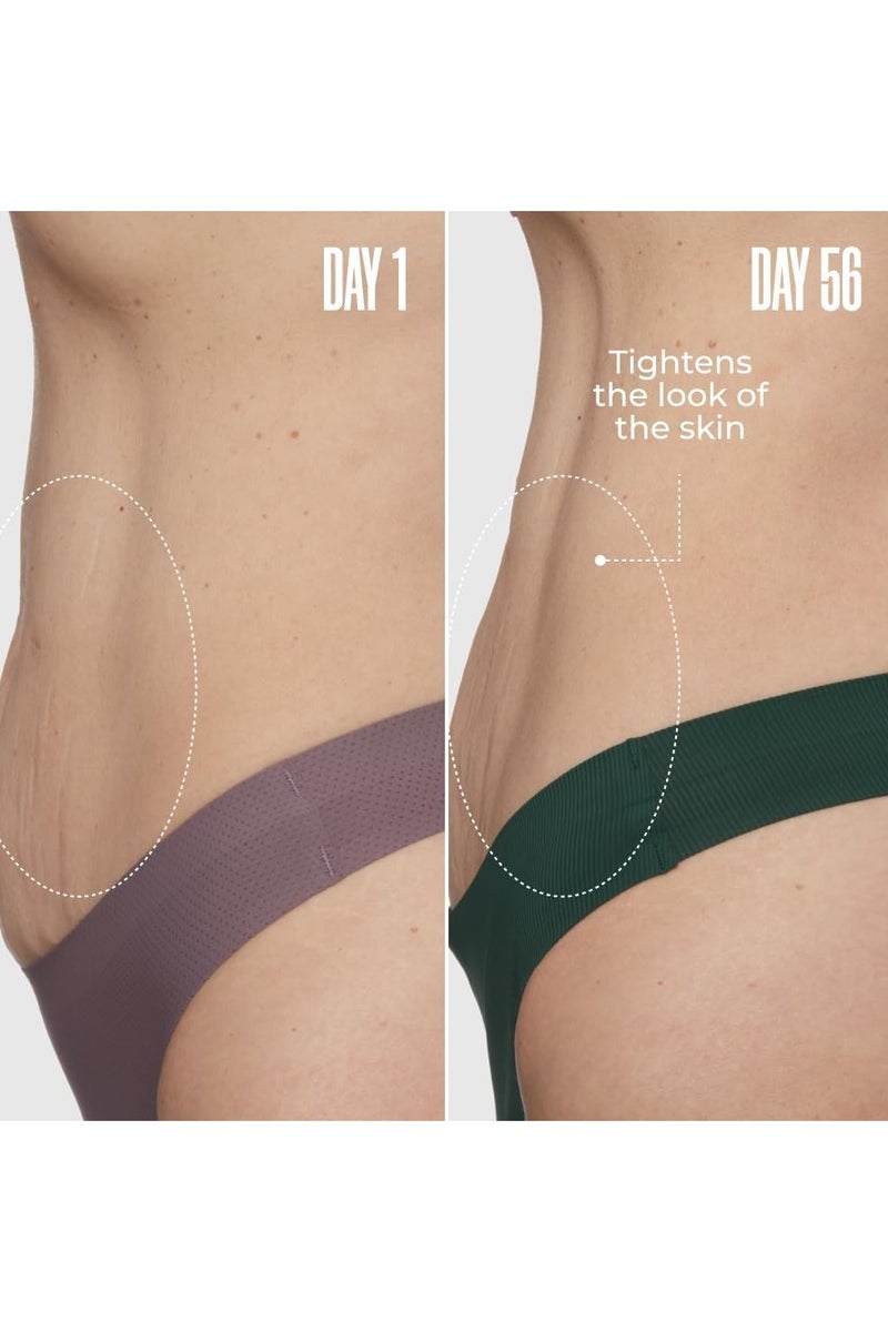 Maelys GET-DREAMY Overnight Toning Whip - Body Firming Whip That Works While You Sleep - Helps Target The Appearance Of Loose Skin On The Body - Image 4