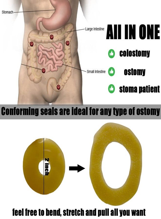 MUROCEA Ostomy Barrier Ring with Directional Spout - 4mm Thickness Disposable Colostomy Cohesive Seal Strip for Ileostomy Stoma System, Outer Dia.2~4", 10 Pcs - Image 2