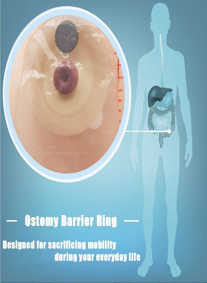 MUROCEA Ostomy Barrier Ring with Directional Spout - 4mm Thickness Disposable Colostomy Cohesive Seal Strip for Ileostomy Stoma System, Outer Dia.2~4", 10 Pcs - Image 5