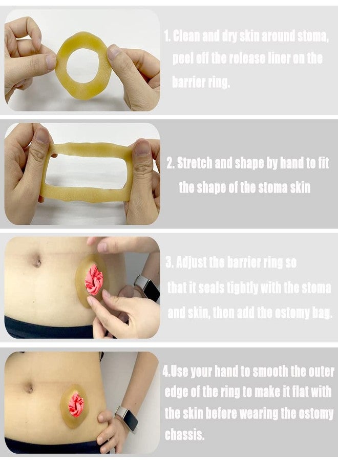MUROCEA Ostomy Barrier Ring with Directional Spout - 4mm Thickness Disposable Colostomy Cohesive Seal Strip for Ileostomy Stoma System, Outer Dia.2~4", 10 Pcs - Image 4