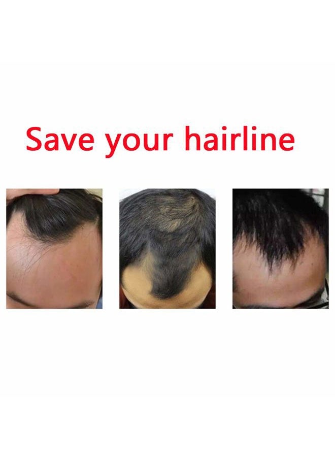 ZigZag Hair - Mens Hairline Toupee 1.5x7inch V-Shape Toupee for Men Real Human Hair Soft Thin Skin Mens Hairpieces Hair Replacement System (1.5x7inch, 1B) - Image 1