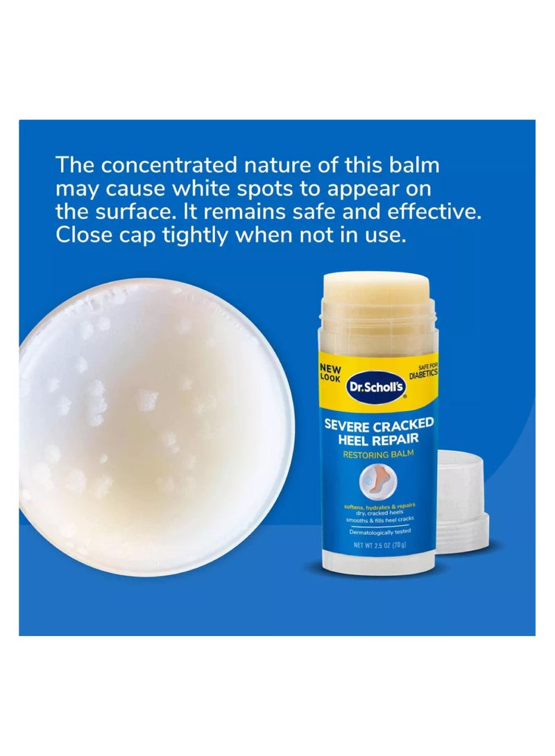 Dr. Scholl's Severe Cracked Heel Repair Restoring Balm - Intensely Hydrates & Softens for Healthy Feet with 25% Urea (2.5 oz) - Image 3