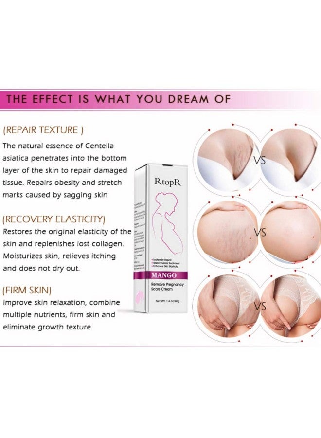 klarako Stretch Mask & Scar Removal Cream for Pregnancy Remove Acne Scars with Natural Herbal Extracts Anti Cellulite and Stretch Marks Remover Massage Safe for All Skin Types Onkessy - Image 2