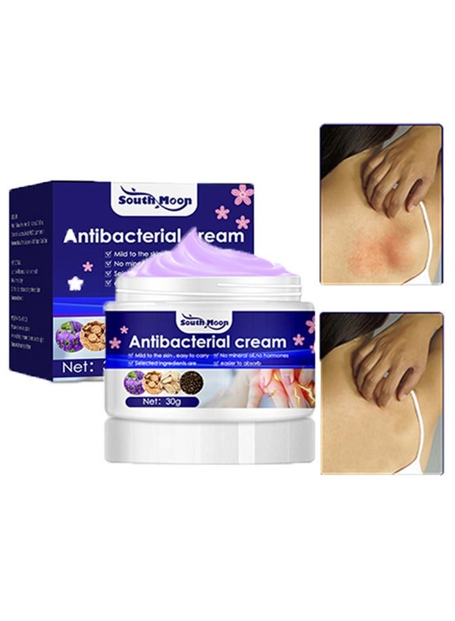 كريم مضاد للجراثيم ، حكة كريم العناية بالبشرة ، لدغة البعوض كريم مضاد للحكة