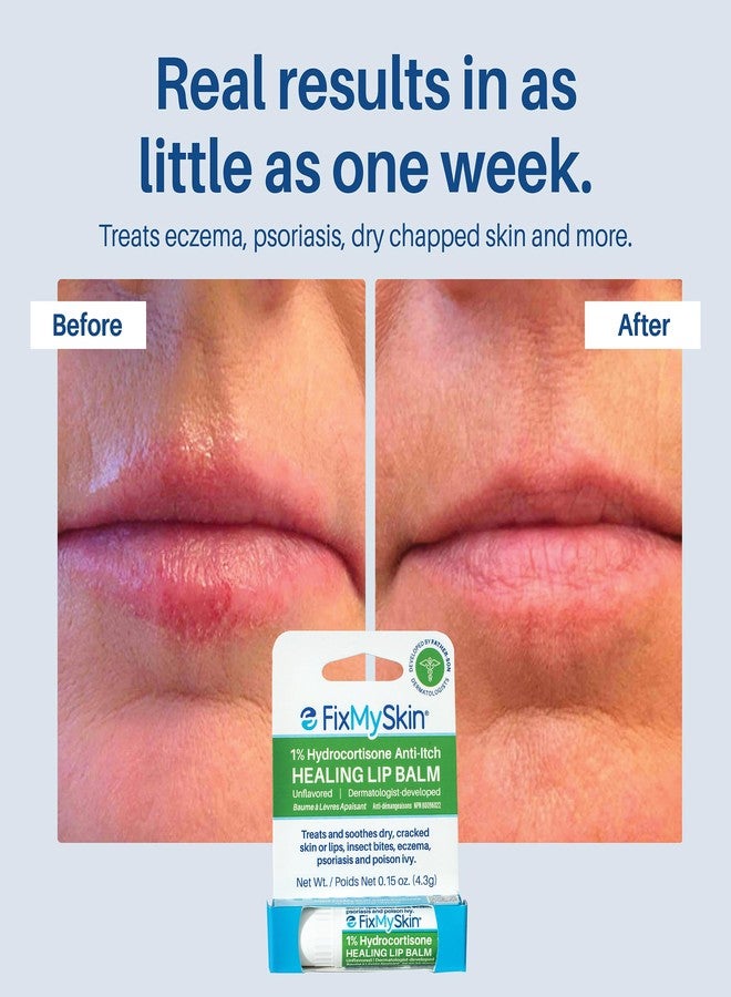 FixMySkin 1% Hydrocortisone Healing Lip Balm, Unflavored – Soothes Dry, Cracked & Irritated Lips, Relieves Chapped Lips, Cold Sores & Eczema, Dermatologist Developed, Travel-Friendly Tube, 0.15 oz - Image 5