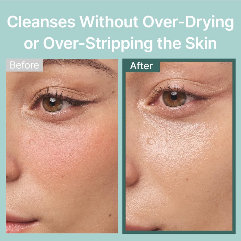 Illiyoon منظف وجه عميق لطيف إيللييون 250 مل (8.45 أونصة سائلة) - Image 5