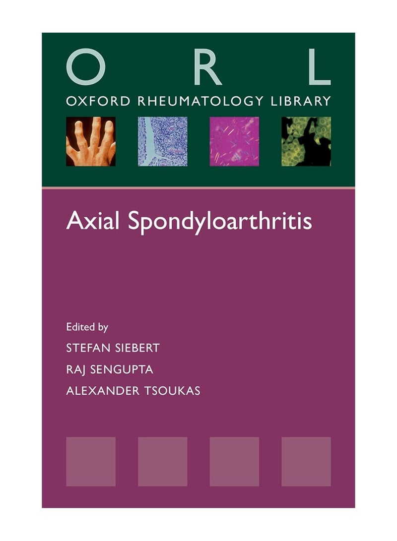 Axial Spondyloarthritis Paperback 
