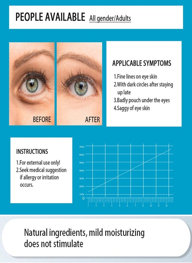 Felico Under Eye Mask Patches, 30 Pairs Collagen Hydrating Moisturizing Smoothing Gel Pads for Puffy Eyes Bags,Dark Circles,Puffiness,Fine Lines,Wrinkles,Anti-Aging Sakura - Image 4