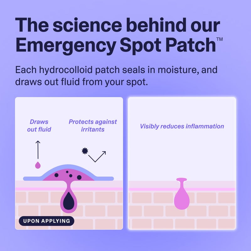 Curology Emergency Spot Pimple Patches for Face, Stocking Stuffer Gifts, Hydrocolloid Pimple Patches Fast-Acting, 40 Count - Image 5