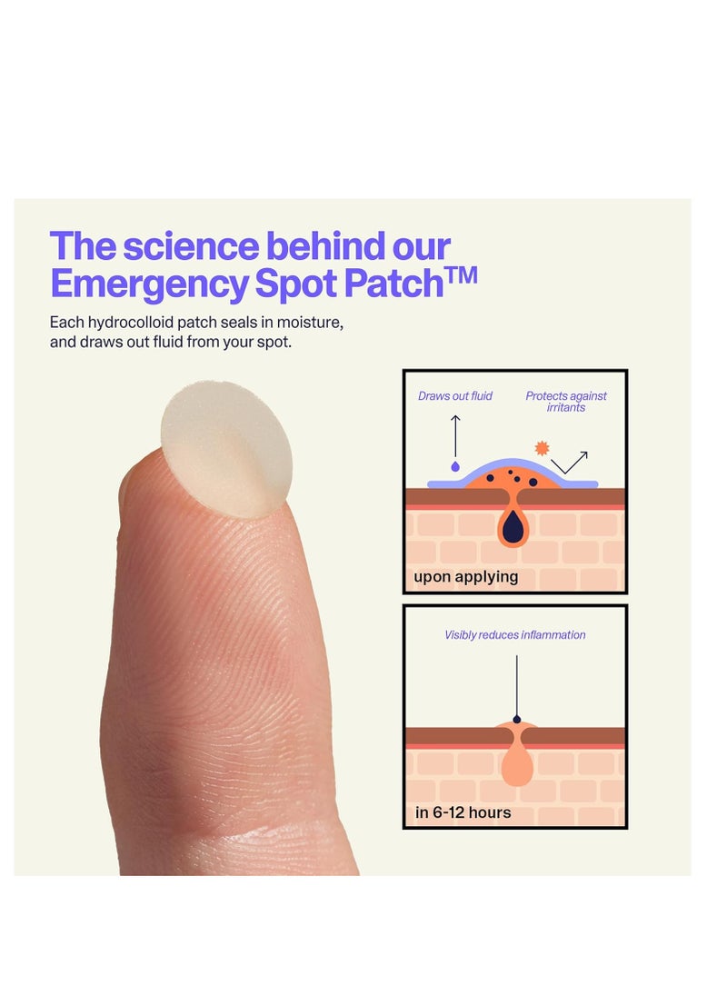 Curology - Curology Emergency Spot Patch, Hydrocolloid Pimple Patches for Face, Fast-Acting Support, Spot Concealing and Oil Absorbing, 40 Count - Image 1