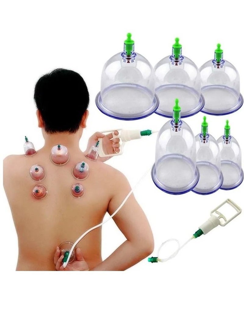 SOSEKO Cupping Hijama Therapy Therapy Sets of 12 pcs Pull Out A Vacuum - Image 1