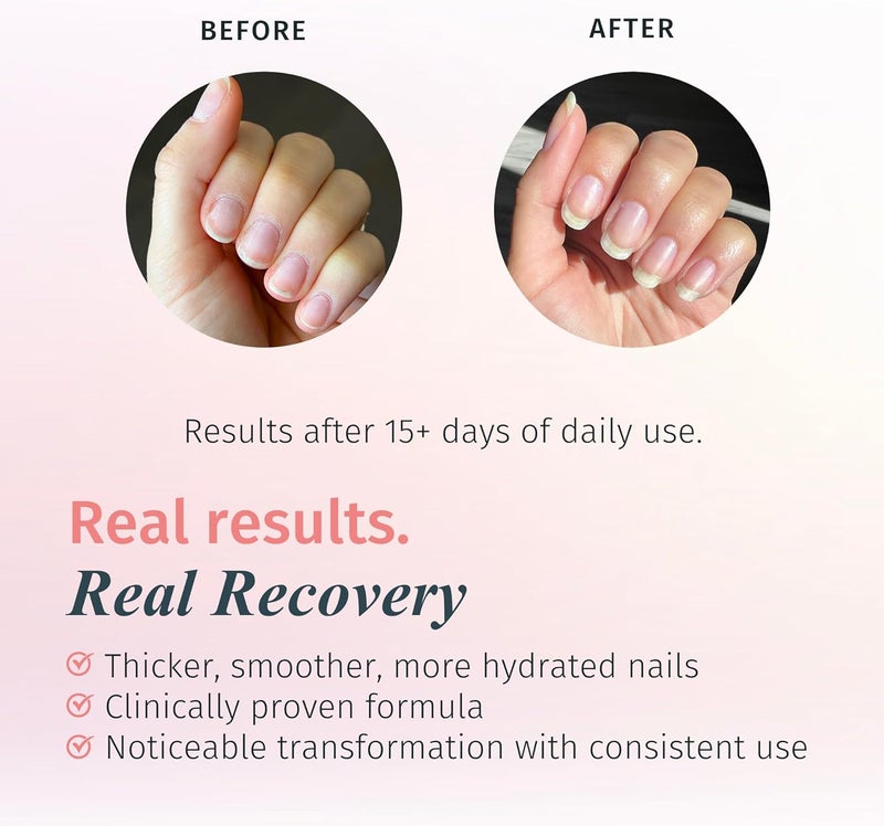 duri Rejuvacote 1 Nail Growth System - Maximum Strength Formula for Nail Strengthening and Growth - 0.45 fl. oz. - Image 2